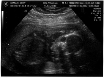 010207-baby-1.jpg