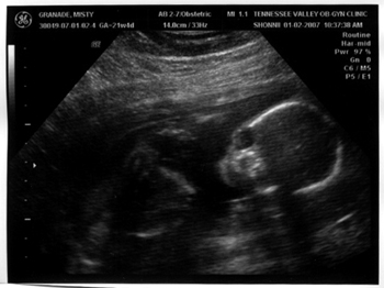 010207-baby-2.jpg