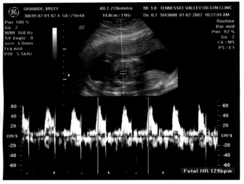 010207-baby-3.jpg