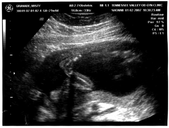 010207-baby-5.jpg